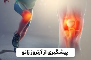 درمان آرتروز زانو در مشهد توسط دکتر ابراهیم زاده فوق تخصص جراحی ارتوپد