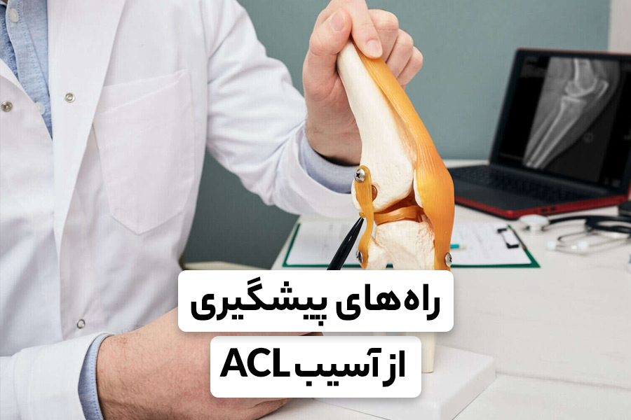 پیشگیری از آسیب ACL