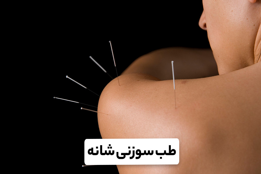 طب سوزنی شانه [نحوه درمان، مزایا و عوارض]